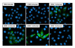 Anti-Dengue virus NS2B protein antibody [HL2513] used in Immunocytochemistry/ Immunofluorescence (ICC/IF). GTX638874